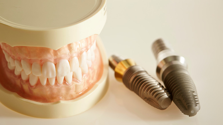 Dentures and implants